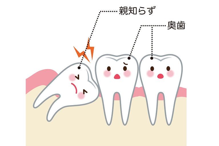 東大阪の八戸ノ里で親知らずの抜歯ならしろくま歯科へ